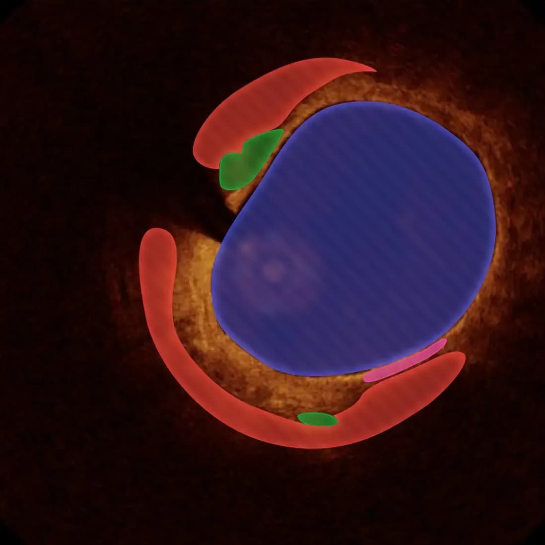 Octiocor hero image