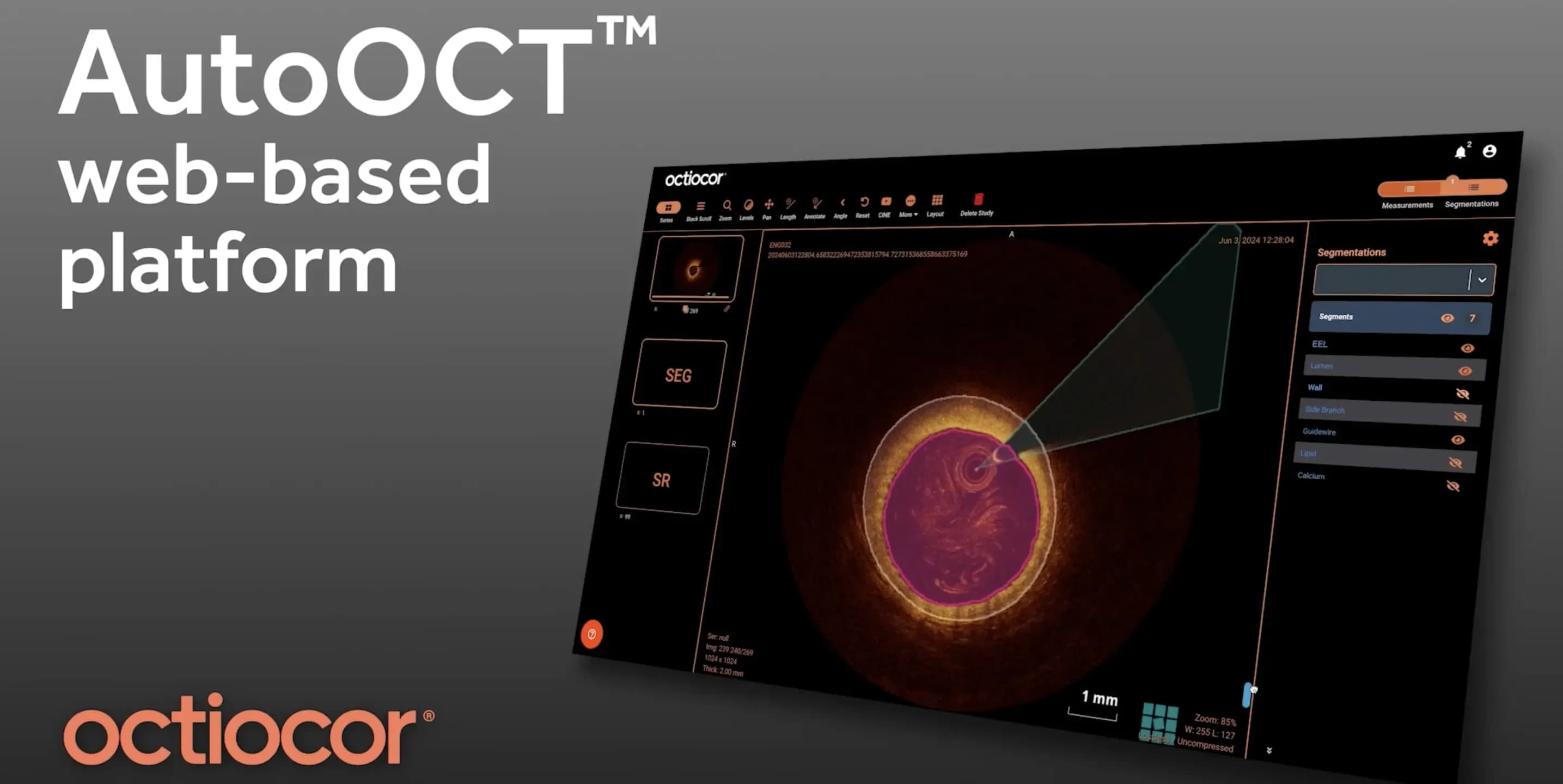 Octiocor blog image.